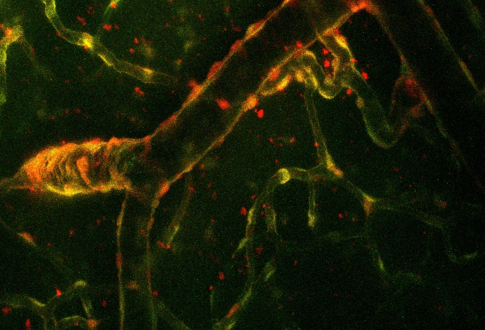 Murine cortical blood vessels imaged with two-photon microscopy.
