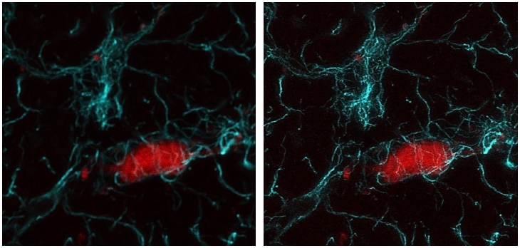 GFAP (cyan) in a murine cortical astrocyte near a pericyte (red) in super or standard resolution STED image.